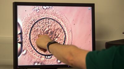 Introducing a sperm to an egg during an IVF procedure in the lab of Sims clinic in Dublin. Photograph: Alan Betson