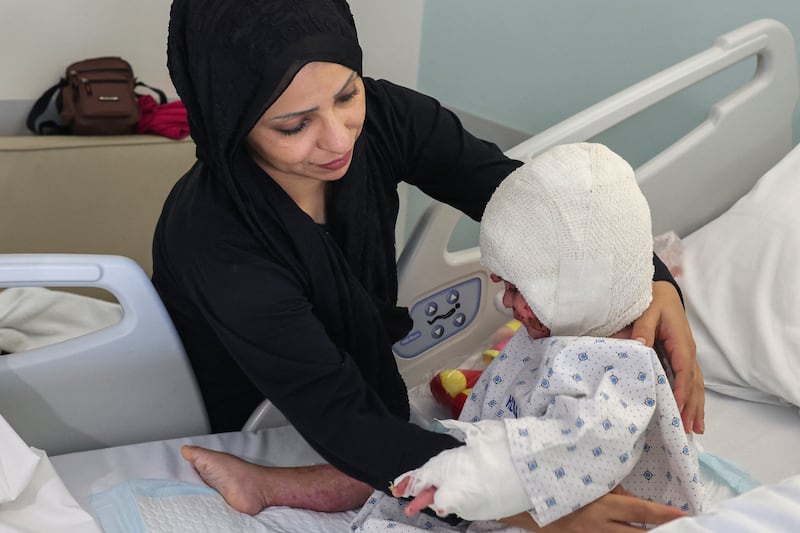 Fatima Zayoun with her two-year-old daughter Ivana Skayki, who suffered third-degree burns in an Israeli strike in southern Lebanon,  at Geitaoui Hospital in Beirut. Photograph: Anwar Amro/AFP via Getty Images