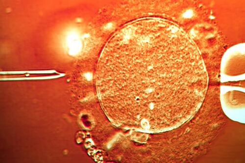 Husband and wife seek damages over claim of destroyed embryos at fertility clinic
