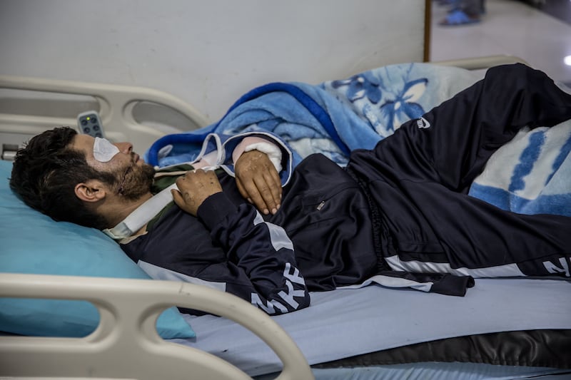 A SDF soldier who lost an eye and broke his hand as a result of a drone attack at the Tishreen Dam. Photograph: Sally Hayden