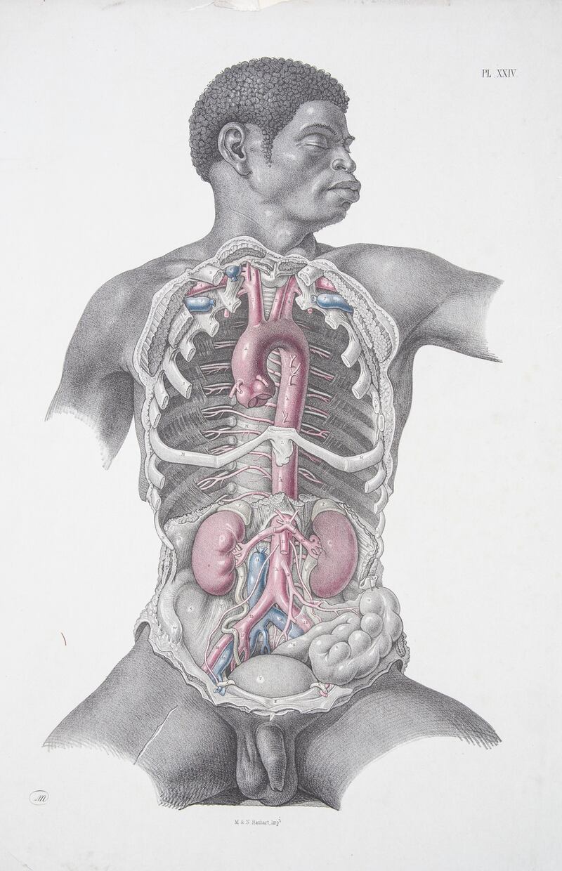 Lot 325 – One of the coloured lithographs from Surgical Anatomy 1856, (€50–€100)