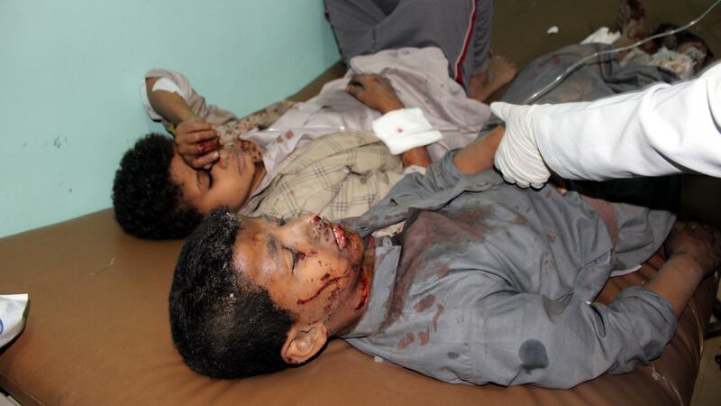 Wounded Yemeni children lay on a bed receiving treatment at a hospital after being injured in a Saudi-led air strike in the northern province of Sa’ada on Thursday. Photograph: EPA