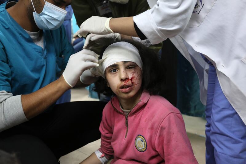 A Palestinian child, heavily injured in an Israeli attack on Nuseirat refugee camp, undergoes treatment at Al Aqsa Martyrs Hospital in Deir al Balah, Gaza, in March. Photograph: Ashraf Amra/Anadolu via Getty