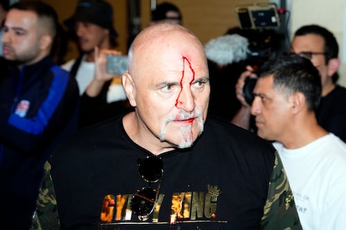 Tyson Fury’s father suffers cut to head as Oleksandr Usyk fight week begins