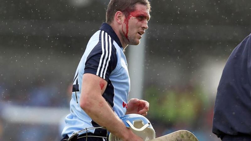 Dublin’s Conal Keaney bears the scars of battle during Sunday’s Leinster Senior Hurling  Championship quarter-final replay at Parnell Park. Photograph: Donall Farmer/Inpho