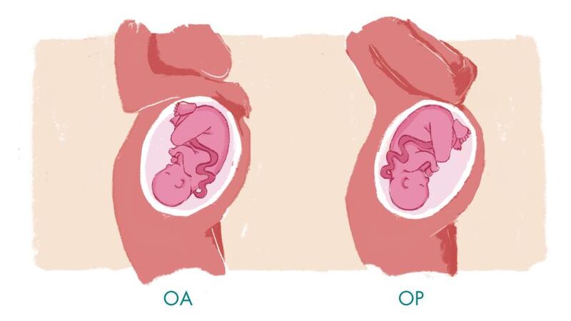 Illustration: Dearbhla Kelly/Irish Times Premedia