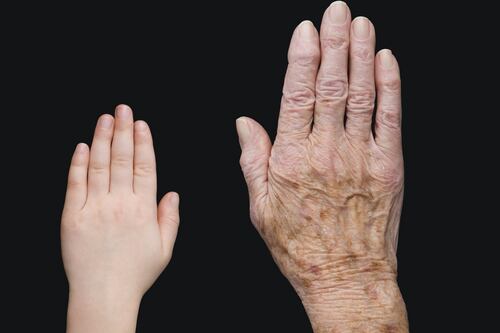 Juvenile idiopathic arthritis: the invisible disease 1,200 Irish children live with