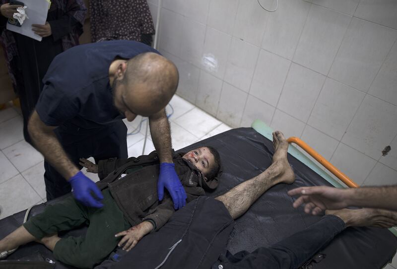 A Palestinian doctor checks a child injured following Israeli airstrikes in southern Gaza at the Nasser Hospital in Khan Younis. Photograph: Haitham Imad/AFP