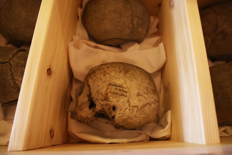 The skulls had been smuggled from Inishbofin by academic Alfred Haddon and his colleague Andrew Dixon in 1890. Photograph: Nick Bradshaw for The Irish Times