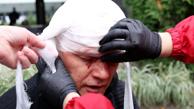 People provide medical care to an injured man during a protest against the Belarus presidential election results in Minsk on October 11th. Photograph: Stringer/AFP via Getty Images