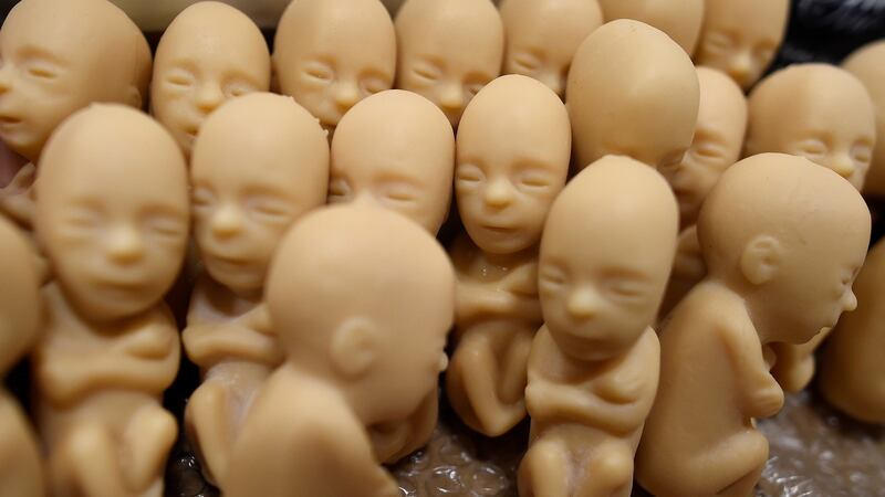 Foetus models are seen on a pro-life stall at the pastoral congress at the World Meeting of Families at the RDS in  Dublin. Photograph: Reuters/ Clodagh Kilcoyne