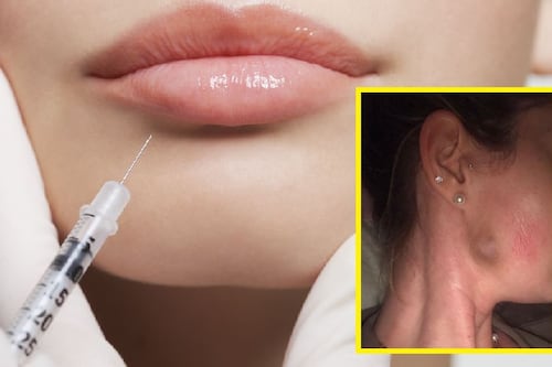 ‘Botched’ dermal filler leaves woman with physical and emotional scars