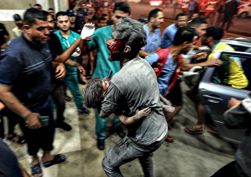 An injured child is rushed into a hospital in Khan Younis following an Israeli air strike on Tuesday. Photograph: Yousef Masoud/New York Times
                      