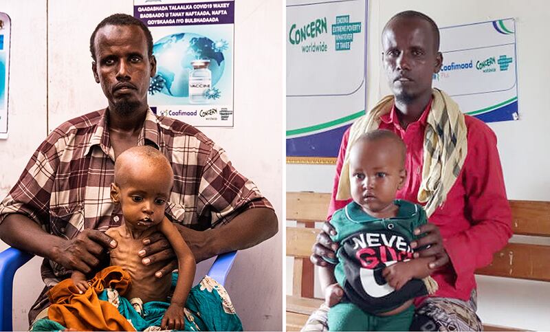 *Ali (38) travelled 400km to get help for his malnourished son *Jama when he was sick. The image on the right was taken after three months of therapeutic food transformed Jama into a healthy toddler Photograph: Ed Ram/Concern Worldwide