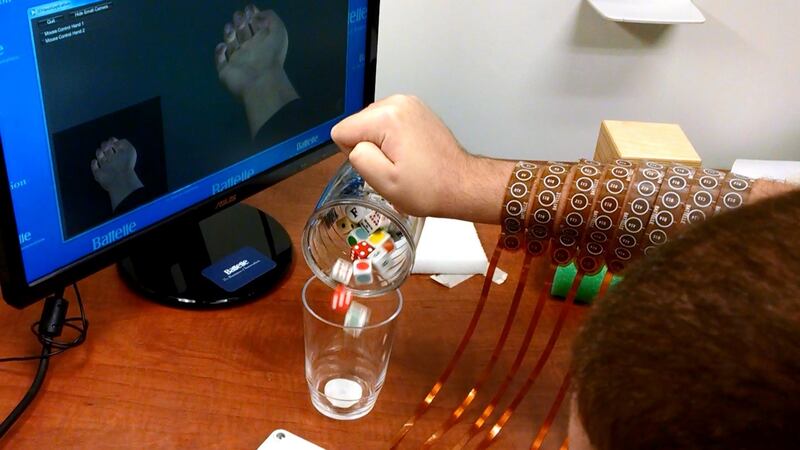 Ian Burkhart (24), who has regained functional use of his hand through the use of neural-bypass technology. Photograph: Ohio State University/Batelle