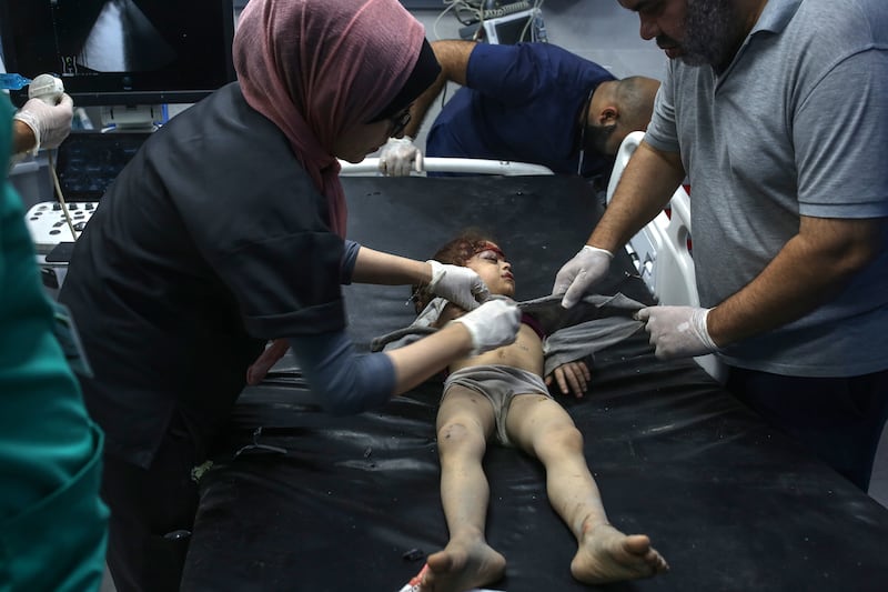 An injured child receives treatment at the Al-Shifa Hospital following Israeli air strikes on Gaza City on Wednesday. Photograph: Samar Abu Elouf/New York Times
                      