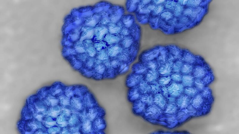 Papilloma viruses  viewed under an electron microscope. They are involved In certain cancers of the cervix. Photograph:   Getty Images