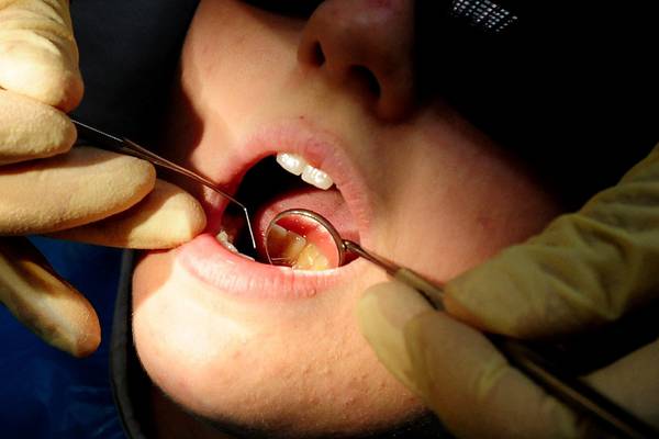 Free dental care plan would cost €80m a year, ESRI says