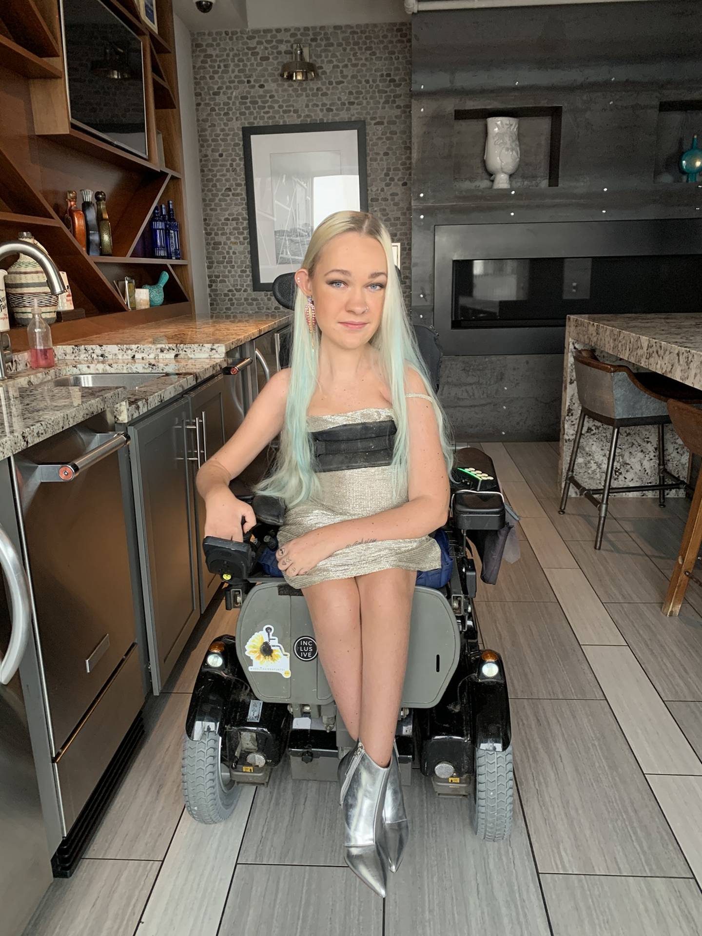 Alex Dacy dubbed 'Wheelchair Rapunzel' who was born with spinal