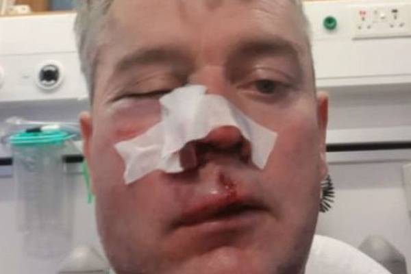 Gardaí to arrest three men in connection with referee attack