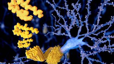 Searching for Alzheimer clues inside the brains cells as well as out
